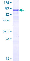 ab159801 on a 12.5% SDS-PAGE stained with Coomassie Blue.