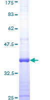 ab159802 on a 12.5% SDS-PAGE stained with Coomassie Blue.