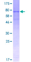 ab160239 on a 12.5% SDS-PAGE stained with Coomassie Blue.