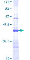 ab160240 on a 12.5% SDS-PAGE stained with Coomassie Blue.