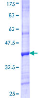 ab163077 on a 12.5% SDS-PAGE stained with Coomassie Blue.
