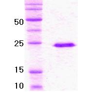 14% SDS-PAGE gel loaded with recombinant Von Hippel Lindau protein.