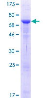 ab164988 on a 12.5% SDS-PAGE stained with Coomassie Blue.
