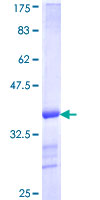 ab163195 on a 12.5% SDS-PAGE stained with Coomassie Blue.