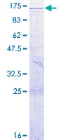 ab161608 on a 12.5% SDS-PAGE stained with Coomassie Blue.