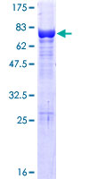 ab162109 on a 12.5% SDS-PAGE stained with Coomassie Blue.
