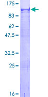 ab159469 on a 12.5% SDS-PAGE stained with Coomassie Blue.