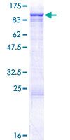 ab163041 on a 12.5% SDS-PAGE stained with Coomassie Blue.