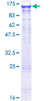 ab162590 on a 12.5% SDS-PAGE stained with Coomassie Blue.