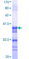ab159807 on a 12.5% SDS-PAGE stained with Coomassie Blue.