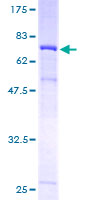 ab161523 on a 12.5% SDS-PAGE stained with Coomassie Blue.