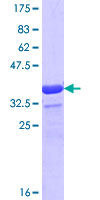 ab152938 on a 12.5% SDS-PAGE stained with Coomassie Blue.