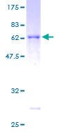 ab161686 on a 12.5% SDS-PAGE stained with Coomassie Blue.