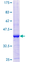 ab161687 on a 12.5% SDS-PAGE stained with Coomassie Blue.