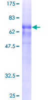 ab161496 on a 12.5% SDS-PAGE stained with Coomassie Blue.