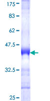 ab161334 on a 12.5% SDS-PAGE stained with Coomassie Blue.