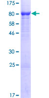 ab160730 on a 12.5% SDS-PAGE stained with Coomassie Blue.