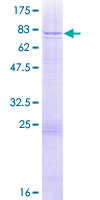 ab163861 on a 12.5% SDS-PAGE stained with Coomassie Blue.