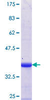 ab163862 on a 12.5% SDS-PAGE stained with Coomassie Blue.