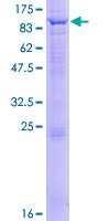 ab165539 on a 12.5% SDS-PAGE stained with Coomassie Blue.