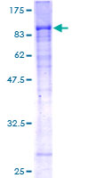 ab164880 on a 12.5% SDS-PAGE stained with Coomassie Blue.