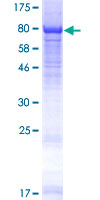 ab164264 on a 12.5% SDS-PAGE stained with Coomassie Blue.