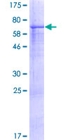 ab164799 on a 12.5% SDS-PAGE stained with Coomassie Blue.