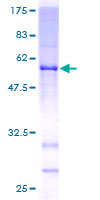 ab161462 on a 12.5% SDS-PAGE stained with Coomassie Blue.