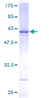ab161153 on a 12.5% SDS-PAGE stained with Coomassie Blue.