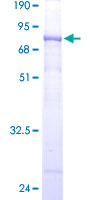 ab163038 on a 12.5% SDS-PAGE stained with Coomassie Blue.
