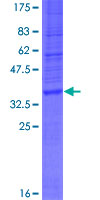 ab164261 on a 12.5% SDS-PAGE stained with Coomassie Blue.