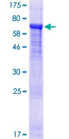 ab164914 on a 12.5% SDS-PAGE stained with Coomassie Blue.