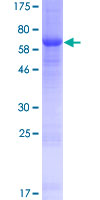 ab164984 on a 12.5% SDS-PAGE stained with Coomassie Blue.