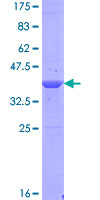 ab162713 on a 12.5% SDS-PAGE stained with Coomassie Blue.