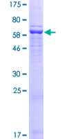 ab165099 on a 12.5% SDS-PAGE stained with Coomassie Blue.