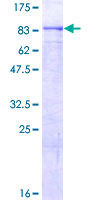 ab161512 on a 12.5% SDS-PAGE stained with Coomassie Blue.