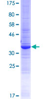 ab165301 on a 12.5% SDS-PAGE stained with Coomassie Blue.