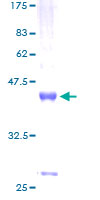 ab165595 on a 12.5% SDS-PAGE stained with Coomassie Blue.