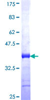 ab165596 on a 12.5% SDS-PAGE stained with Coomassie Blue.