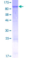 ab165224 on a 12.5% SDS-PAGE stained with Coomassie Blue.