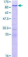 ab159810 on a 12.5% SDS-PAGE stained with Coomassie Blue.