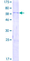 ab153164 on a 12.5% SDS-PAGE stained with Coomassie Blue.