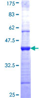ab153165 on a 12.5% SDS-PAGE stained with Coomassie Blue.