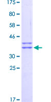ab162949 on a 12.5% SDS-PAGE stained with Coomassie Blue.