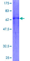 ab164311 on a 12.5% SDS-PAGE stained with Coomassie Blue.