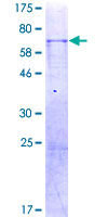 ab159814 on a 12.5% SDS-PAGE stained with Coomassie Blue.