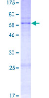 ab159815 on a 12.5% SDS-PAGE stained with Coomassie Blue.