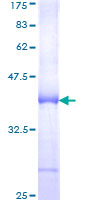 ab152941 on a 12.5% SDS-PAGE stained with Coomassie Blue.