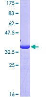 ab157896 on a 12.5% SDS-PAGE stained with Coomassie Blue.
