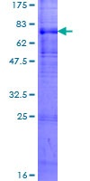 ab159821 on a 12.5% SDS-PAGE stained with Coomassie Blue.
